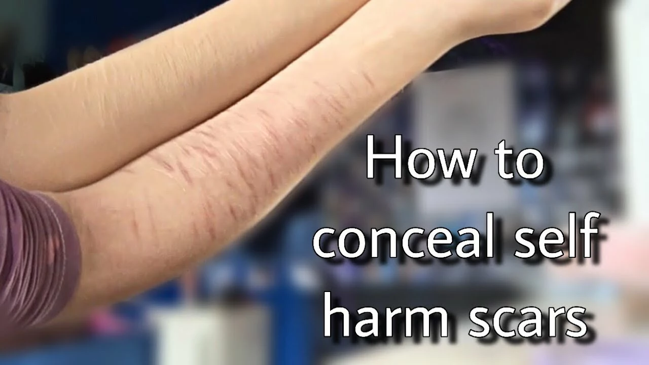 How to manage scars from self-harm and promote healing
